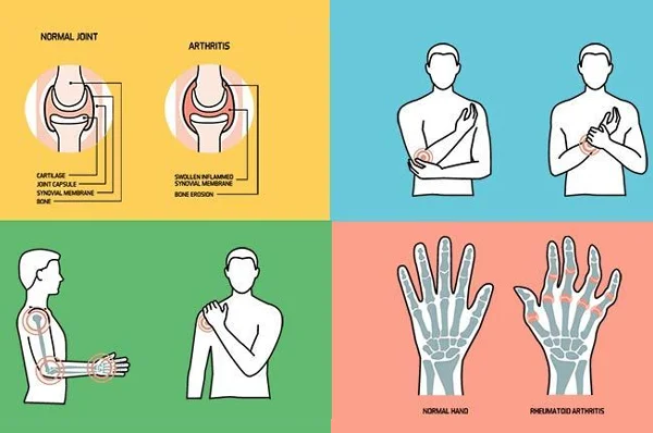 Pain Nivaran Clinic