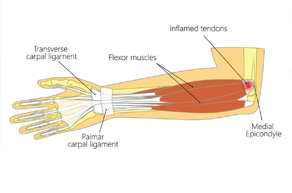 Pain Nivaran Clinic