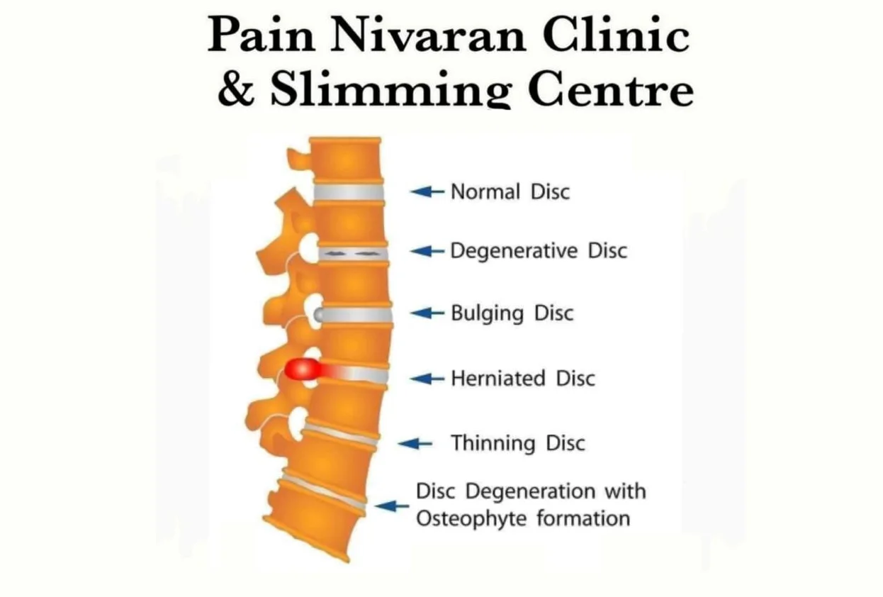 Pain Nivaran Clinic
